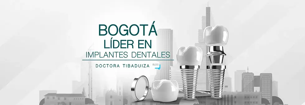 Bogota lider en Implantes Dentales
