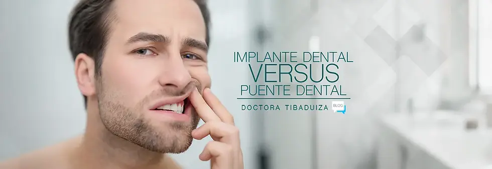Implante Dental VS Puente Dental