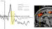 Corticolimbic Mechanisms in the Control of Trial and Error Learning