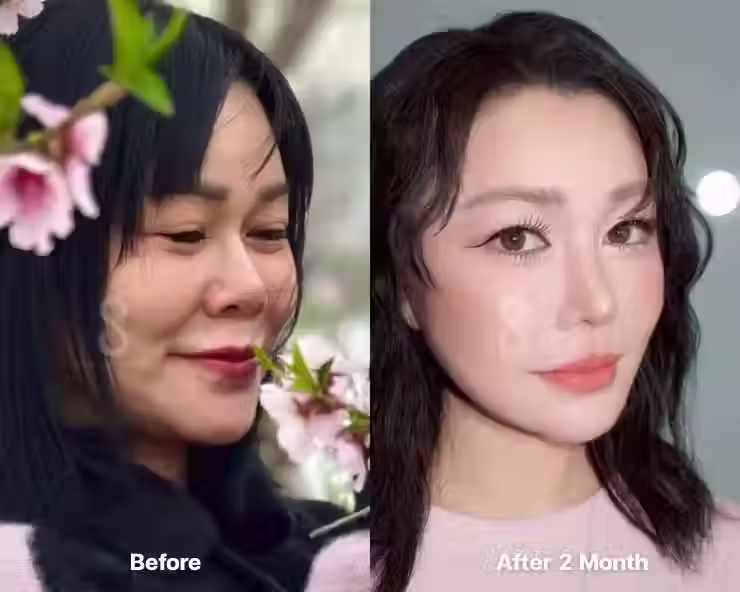 ศัลยกรรมเกาหลีไปกับเรา Mississo Beauty เอเจนซี่ศัลยกรรมเกาหลี