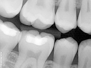 xray.jpeg