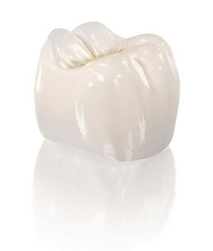 natural_looking_crowns.jpeg