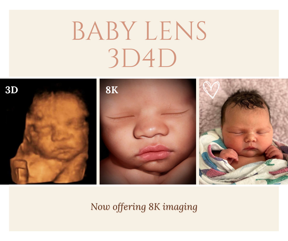 Babylens3d4d Logo