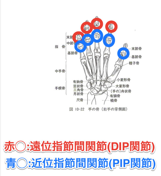 指関節脱臼 新橋
