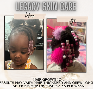 Before picture of toddler girl short curly hair. After picture of toddler girl longer hair.
