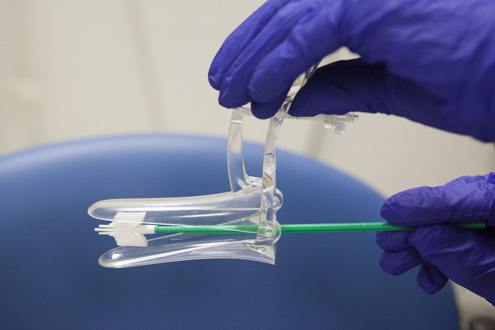 Delays In Smear Test Results