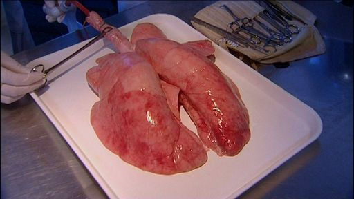 Fresh Lung for dissection