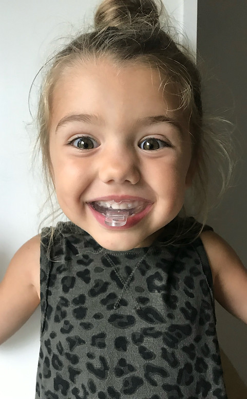 Early Orthodontic Treatment to Fix Teeth without Braces - HealthyStart