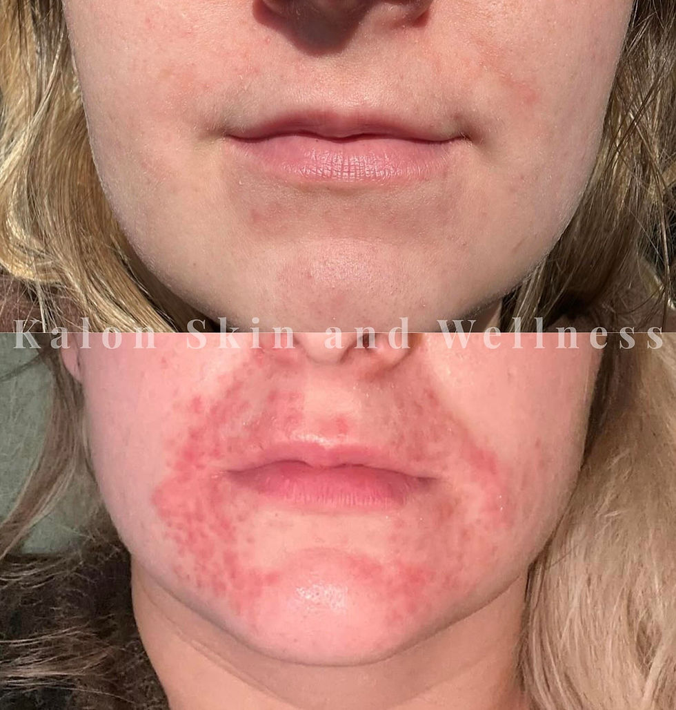 Thumbnail: SIV Biome Balancing Serum