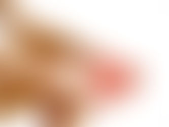 Fasceita plantară: recuperare modernă cu Shockwave (ESWT) + terapie + exerciții