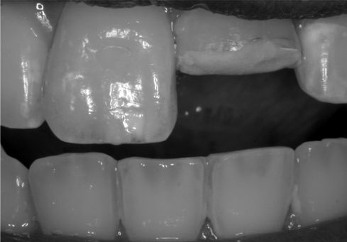 vorher nachher 3_edited.jpg