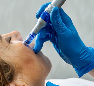 Closeup of a hand using a microneedle pe