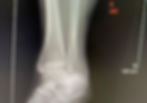 ankle xray