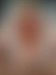 Skinned_IMG Sample
