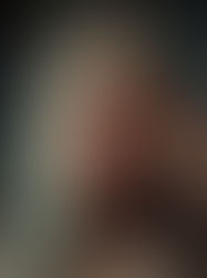 Eye Socket Images - Sample