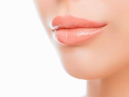 Liplift : le lifting de la lèvre supérieure pour un sourire plus harmonieux