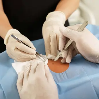 Quelle est la prise en charge des cancers cutanés en chirurgie esthétique ?