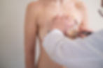 Seins qui "tombent" : quand envisager un lifting des seins, avec ou sans prothèses