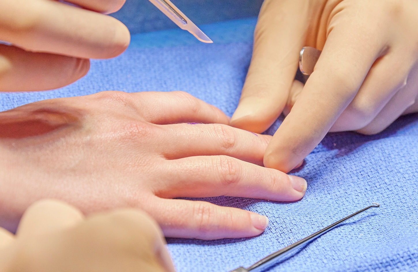 meilleur chirurgien main