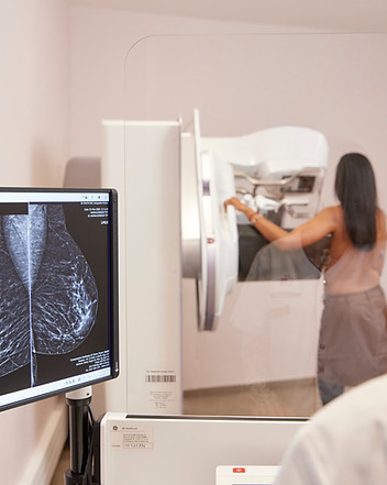 mammographie-centre-bordelais-imagerie-sein