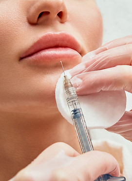 injection acide hyaluronique chirurgien esthétique bordeaux arcachon
