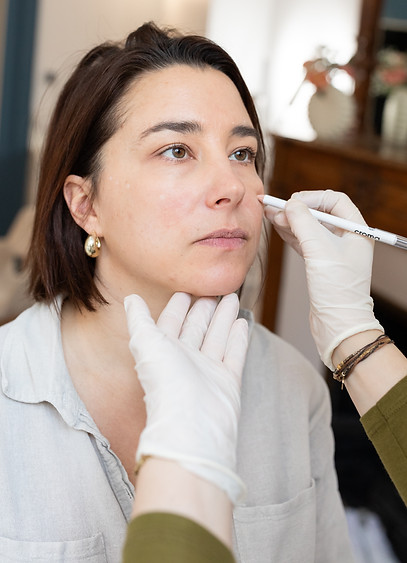médecine esthétique botox acide hyaluronique montpellier
