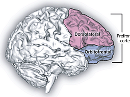 Potenziare le attività cognitive superiori aiuta a ridurre i disturbi d'ansia.