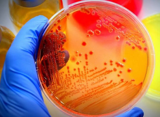 Microbiology-Culture-1-788x443_edited.jp