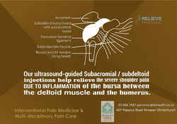 Subacromialsubdeltoid injection_DxO_DxO_DxO