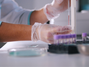 Un examen de sangre puede detectar el cáncer