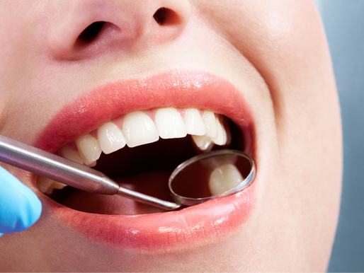 La mala higiene bucal podría estar dañando su corazón