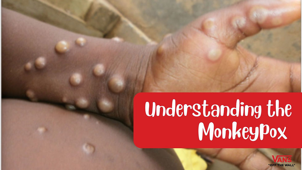 Understanding Mpox: Overview, Management, and Nutritional Support