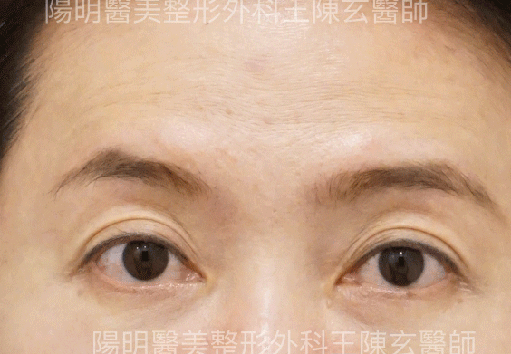 未命名-1.gif
