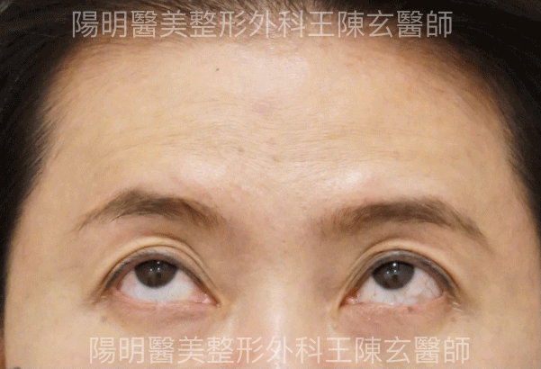 未命名-2.gif