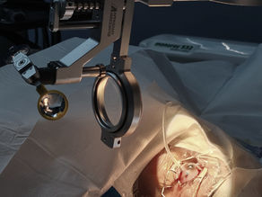 Advanced Cataract with Total Retinal Detachment: Successfully Managed in a Single Surgical Sitting