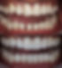 aligners2_edited_edited.jpg