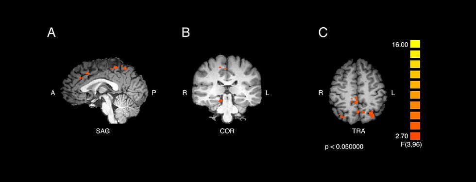 fmri.jpg