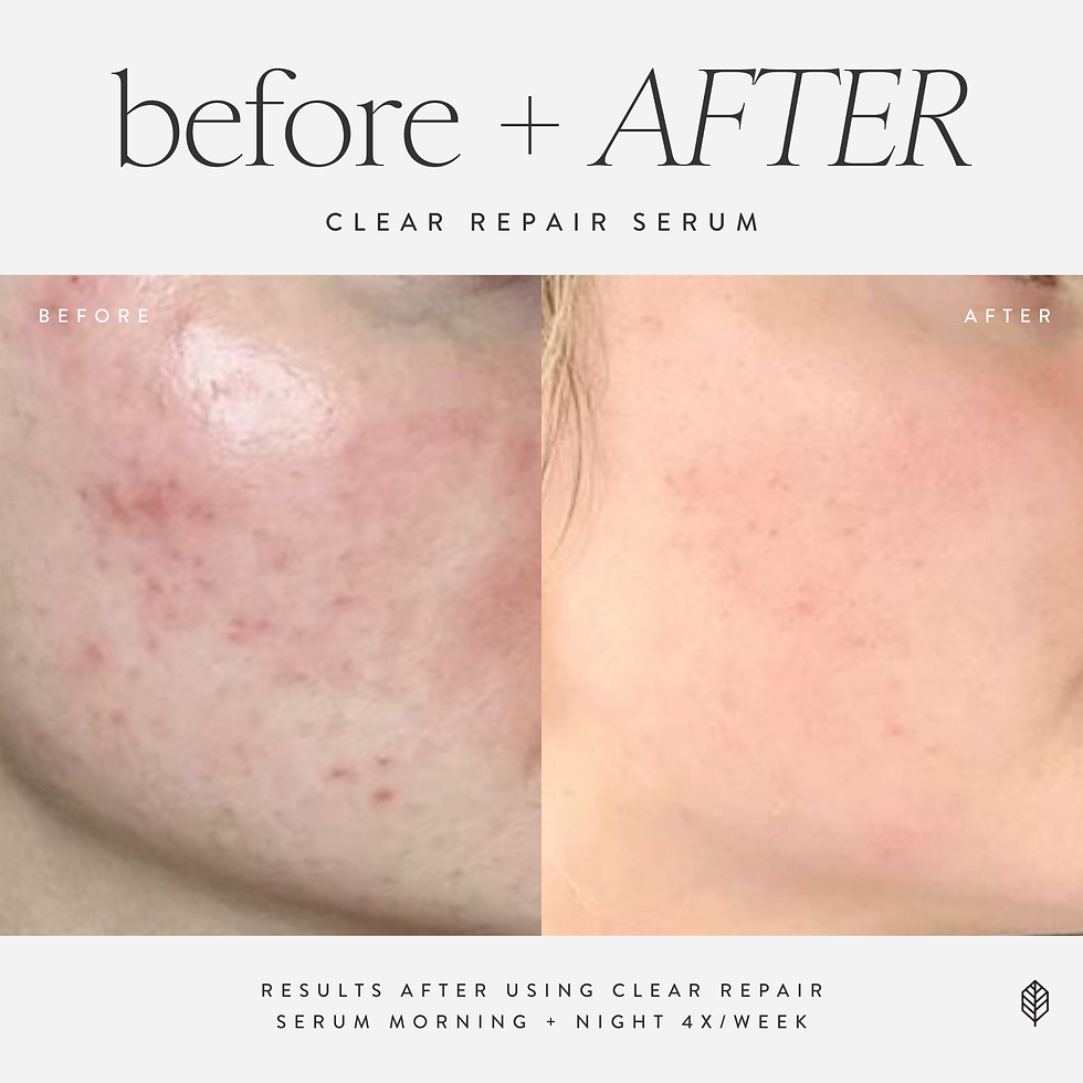 Thumbnail: Clear Repair Serum