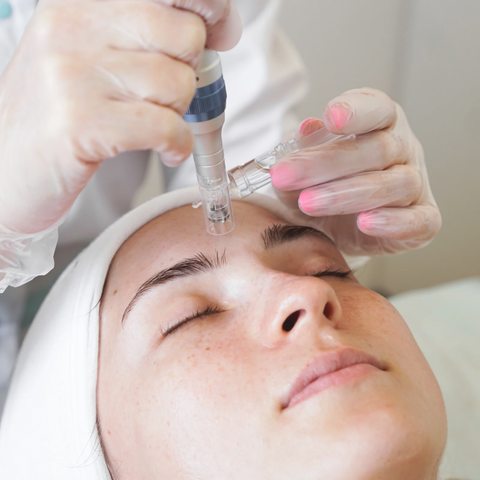 Aileen Bog, Aileen Bog Cosmetics, Kosmetikerin in Mannheim, Microneedling, Microneedling Behandlung, Microneedling Mannheim, Mannheim, Hautprobleme, Hautverbesserung