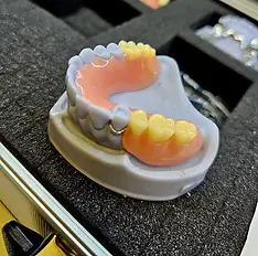 Dental impression with dentures mock-up