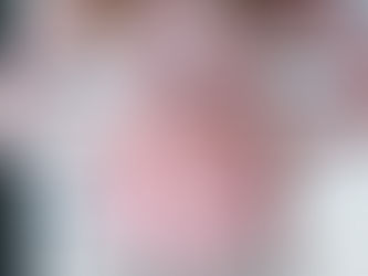 Hydrogen Sulphide SIBO Symptoms & Treatment