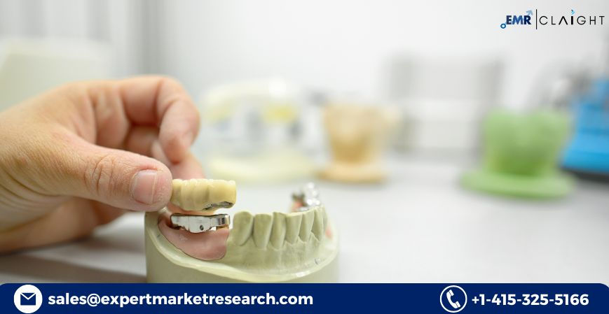 dental laboratories market