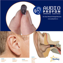 SoundLens Synergy iQ 