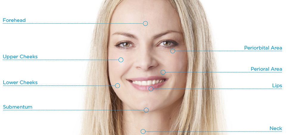 BTL Exilis Elite