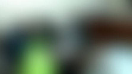 Mabuk, Wanita Cantik Tabrak Sopir Ojol hingga Luka Parah