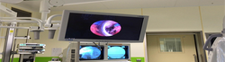 Monitor endoscopia Urologica