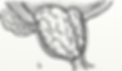 PROSTATA LATERALE GRANDE IPERTROFIA.png