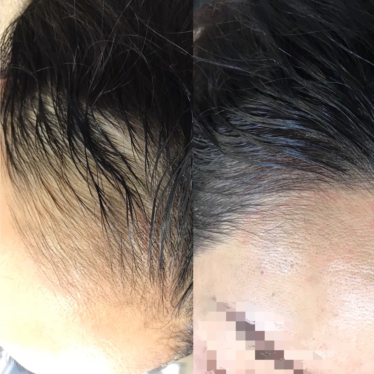 福岡の 女性専用ヘアタトゥー のお店 鳳仙彫