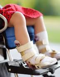 Paediatric-Orthopaedic-3.jpeg