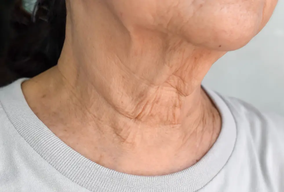 7_Anti-Aging_Tips_to_Snap_Back_Sagging_Neck_Skin_1024x.jpg.webp